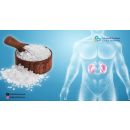 تراكم الاملاح في الجسم