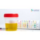 خروج دم مع البول والبراز: الأسباب المحتملة وطرق علاجها