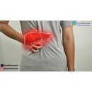 كل ما تريد معرفته عن أعراض تشمع الكبد البسيط 