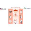هل مرض كرون خطير؟ ما هي أشهر أعراضه وطرق علاجها؟