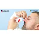 متى يكون سبب نزول الدم من الأنف من فتحة واحدة خطيراً؟