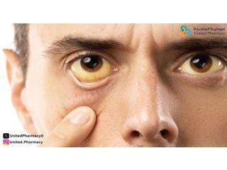 علامات الشفاء من اليرقان عند الكبار