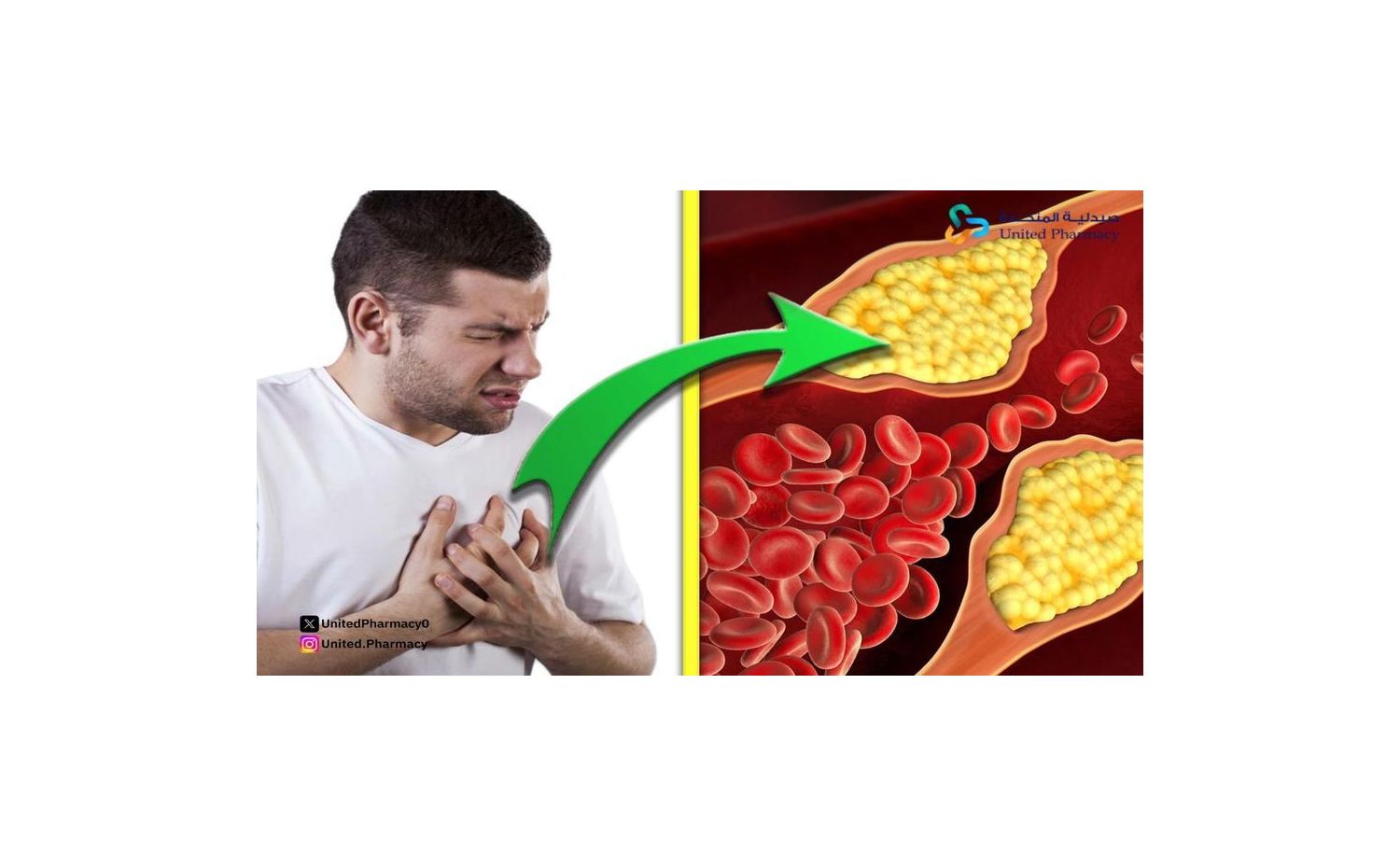 اعراض دواء الكولسترول