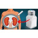 علاج الأملاح في الجسم