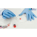 ما هو تحليل WBC ومتى تحتاج إلى إجرائه؟