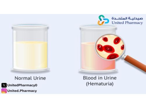 نزول دم مع البول عند المرأة