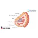 الكيس الدهني في الثدي