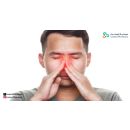 حساسية الأنف