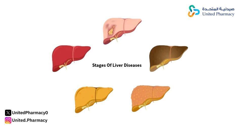 اضطرابات المناعة الذاتية