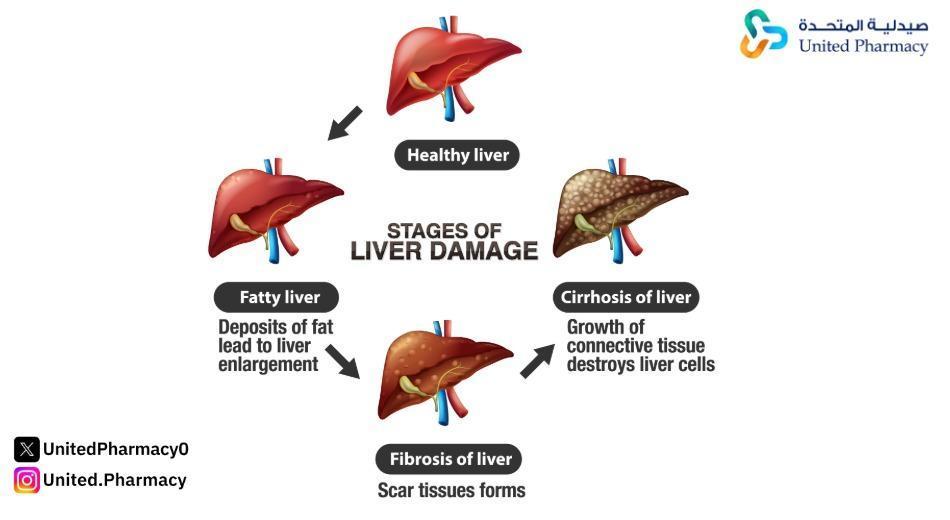هيباتيكم 140