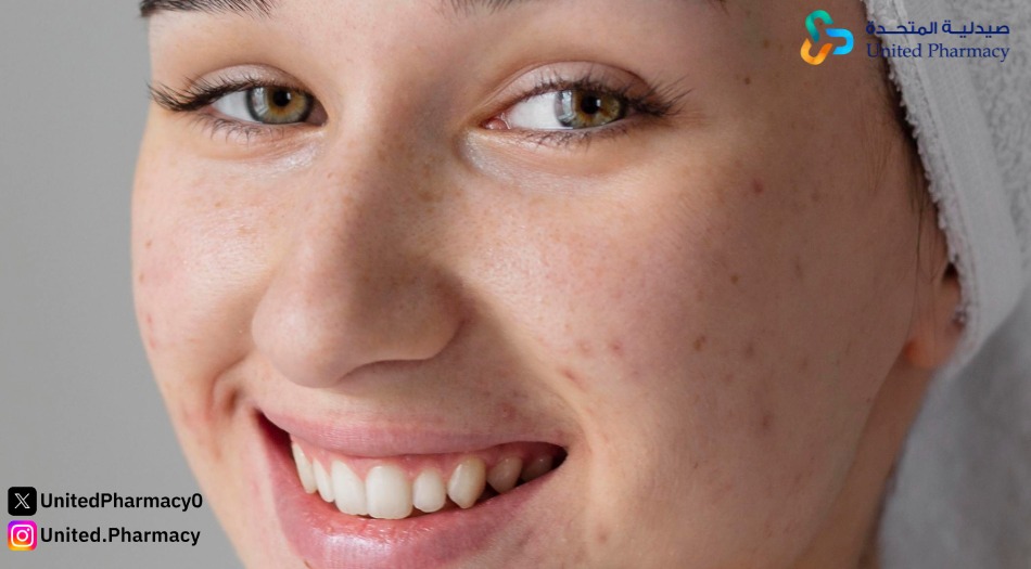 هل الروكتان حل نهائي لحب الشباب؟