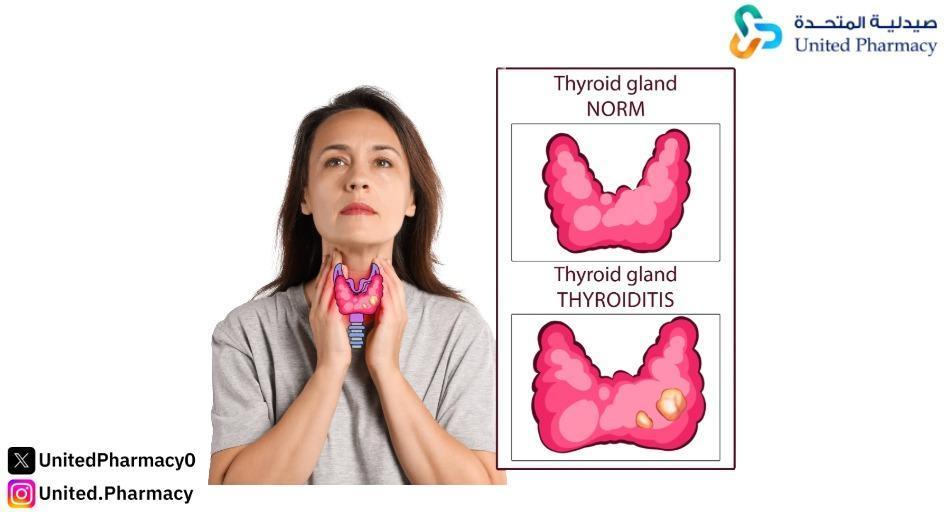 مواضع العُقَد اللمفية