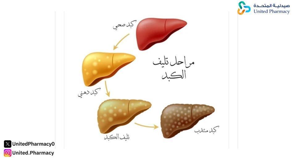 مراحل تليف الكبد