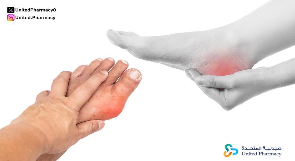 علاج مرض النقرس نهائيا