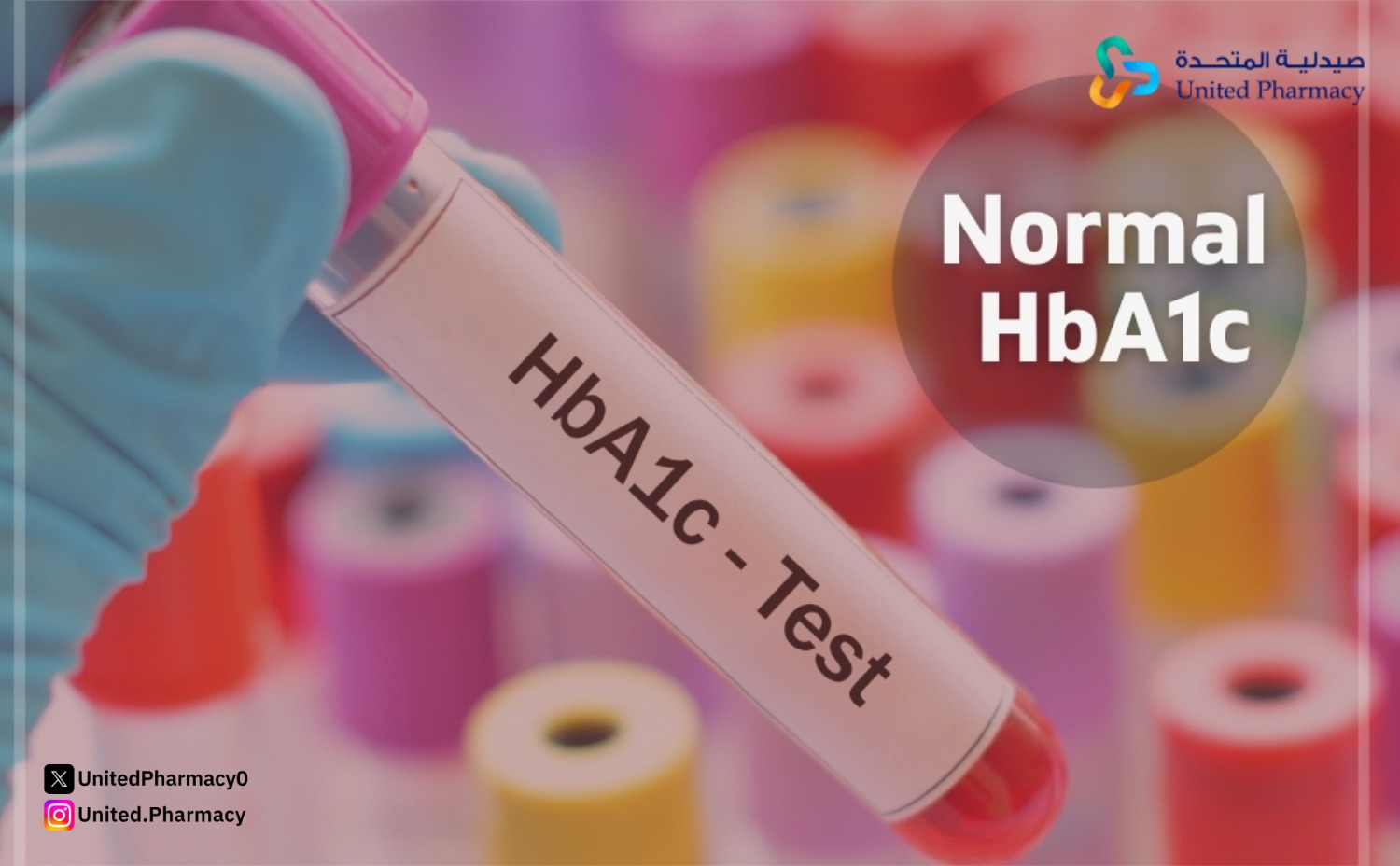 تحليل السكر التراكمي