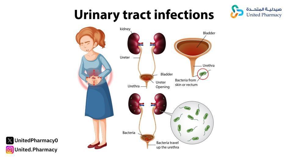 ما هو الفرق بين أعراض التهاب الكلى وأعراض التهاب المسالك؟